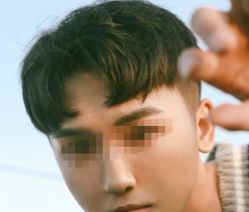 -大麦微针植发丨全国连锁