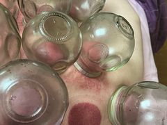 -沈师傅盲人按摩工作室(密三小区店)