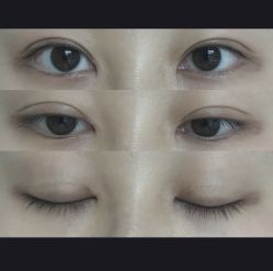 -上海漾颜医疗美容