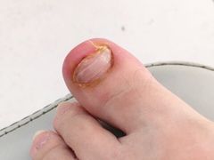 -新甲连锁灰指甲·甲沟炎·鸡眼(黑龙江路店)