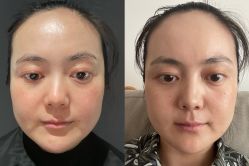 体验后-BR光电保养