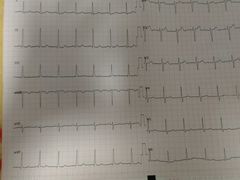 心电图。-北京市健宫医院