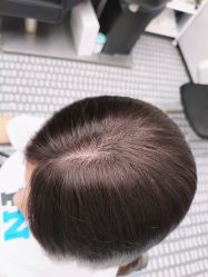 -唐风采假发补发定制