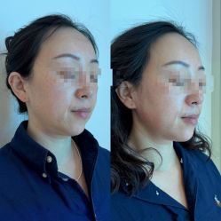 -海菲秀·飞顿牛奶光·LDM官方授权中心美轮美浣瓷感美肌