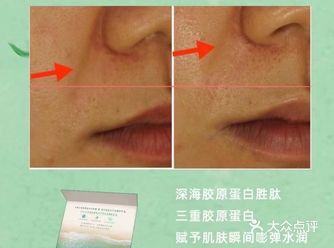 秋季补“胶原”啦！守护你Q弹饱满的皮肤