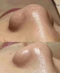 -尊尚柏丽美容SPA