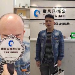 -唐风采假发补发定制