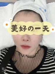 体验后-北京楚诺医疗美容