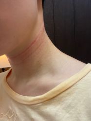 -美莱医疗美容医院