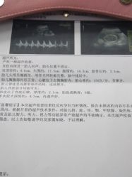 点击看大图 -潍坊艾玛妇产医院