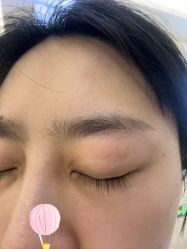 -长沙雅美医疗美容医院