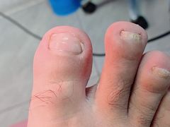 -世龙世家手足健康护理连锁(福田梅林路润裕花园店)