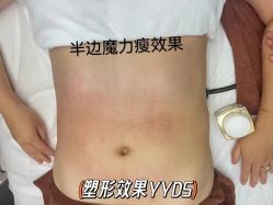 -Lily纤美·科技减脂中心