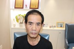 -大麦微针植发丨全国连锁