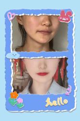 -小忠丽格医美