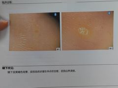 -广州市第一人民医院(院本部)