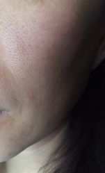 -北京米扬丽格医疗美容·联合丽格鼻整形中心