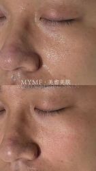 -美愈美肤MEIYU SKIN