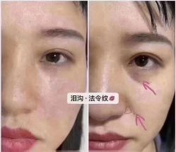 -贝黎诗SPA