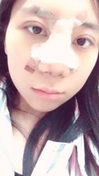 点击看大图 体验后-鑫元辰医疗美容整形