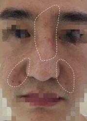 -八大处整形