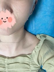 -丽美妍医疗美容·皮秒·立体分层抗衰