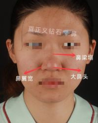 -北京米扬丽格医疗美容·联合丽格鼻整形中心