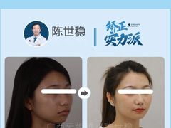 -柏乐口腔(南宁总院)