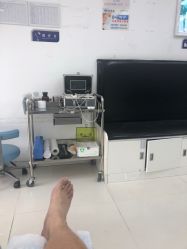 -派恩宜灰指甲鸡眼嵌甲手足癣