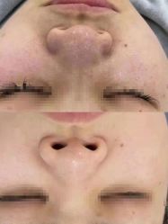 -SKIN79皮肤管理中心