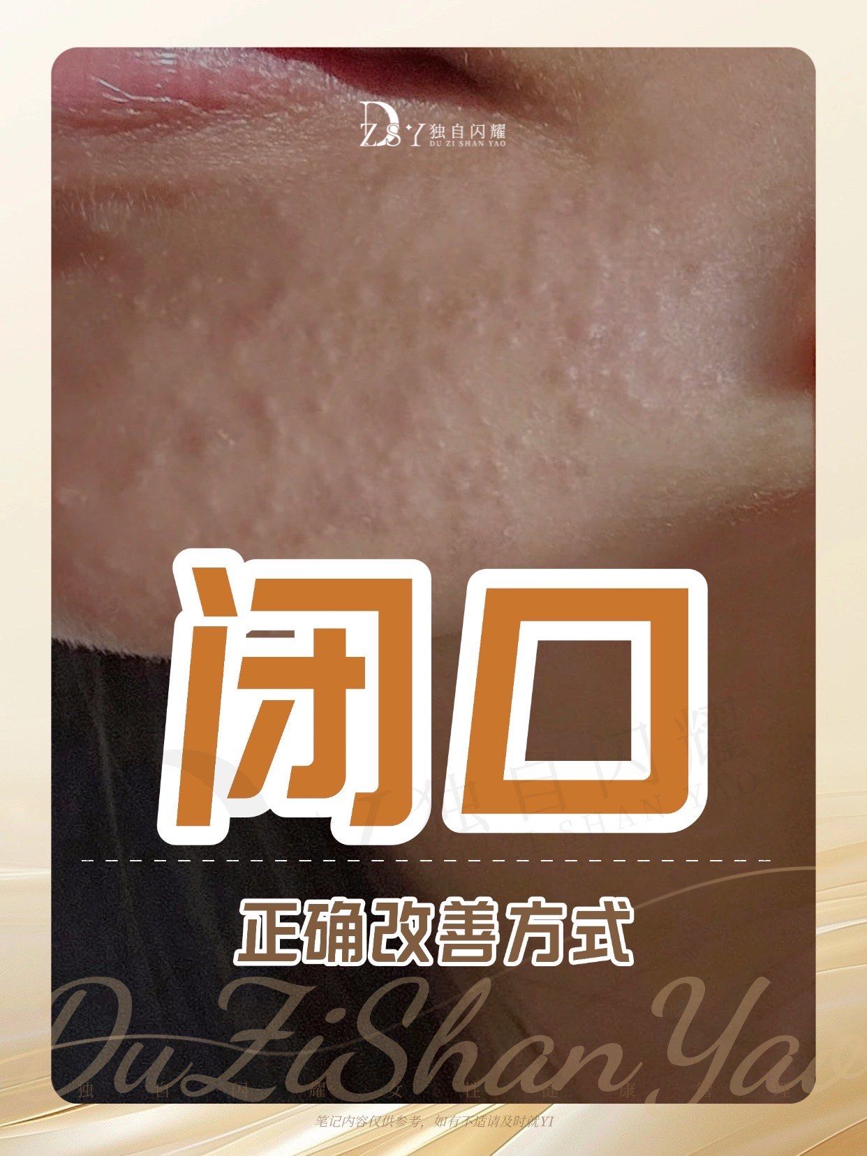 为什么会长闭口粉刺为什么在线