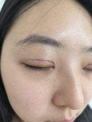 点击看大图 -Yestar艺星整形美容医院