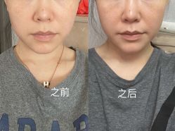 -厦门美莱整形美容医院