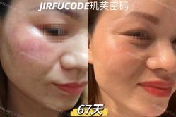 -元熙兰积皮肤管理