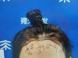 -雍禾植发全国连锁