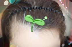 -大麦微针植发全国连锁