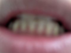 -极光口腔·矫正种植修复(锦江院区)