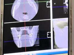 -土豆口腔(凤凰北总店)