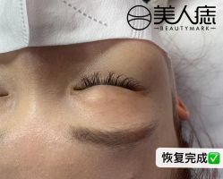 -美人痣全国连锁