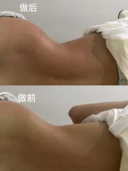 -Lily纤美·科技减脂中心