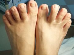 -世龙世家灰指甲鸡眼脚气甲沟炎跖疣护理(通州店)