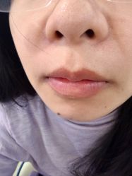 -长沙雅美医疗美容医院