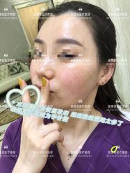 -新美荟医美·专注面部美学抗衰
