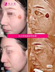点击看大图 -星港国际·Skin皮肤专研·皮肤管理