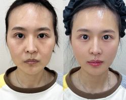 -上海伊莱美医疗美容医院