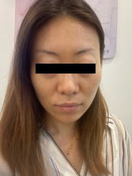 -战痘宣颜科学皮肤管理祛痘中心
