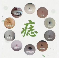 -美人痣全国连锁