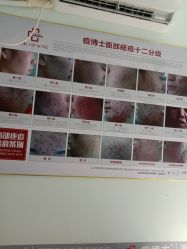 -痘博士广州·全国连锁祛痘机构