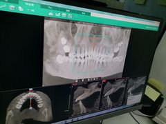 -诺贝尔一诺口腔医院(雁塔院区)