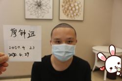 -大麦微针植发丨全国连锁